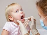 Viêm họng cấp và cách phòng ngừa cho trẻ