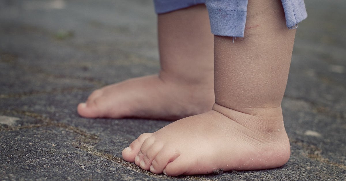 Tìm hiểu về chứng đau bàn chân ở trẻ nhỏ